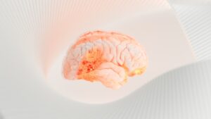 alzheimers disease guide