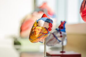 aortic aneurysm guide