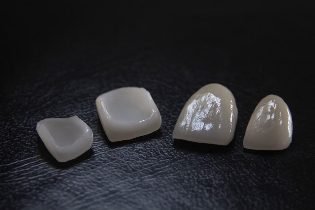 Average Cost of a Tooth Crown