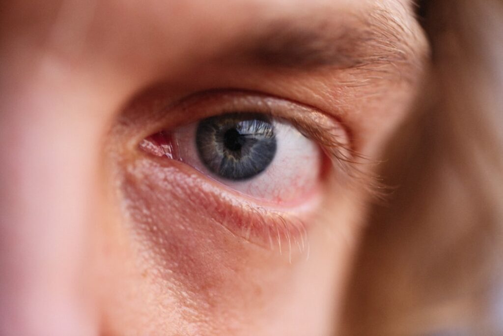 Causes of Eye Pressure Pain: Glaucoma, Sinusitis, and Other Possibilities