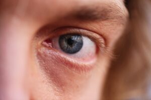 causes of eye pressure pain