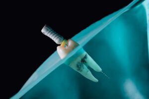 cost of root canal and crown 1
