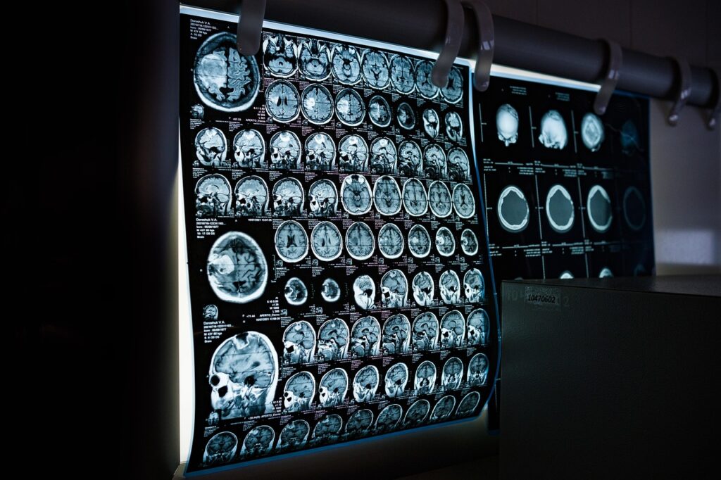 CT Scan: How It Works, Preparation, and What to Expect