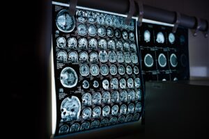 ct scan guide