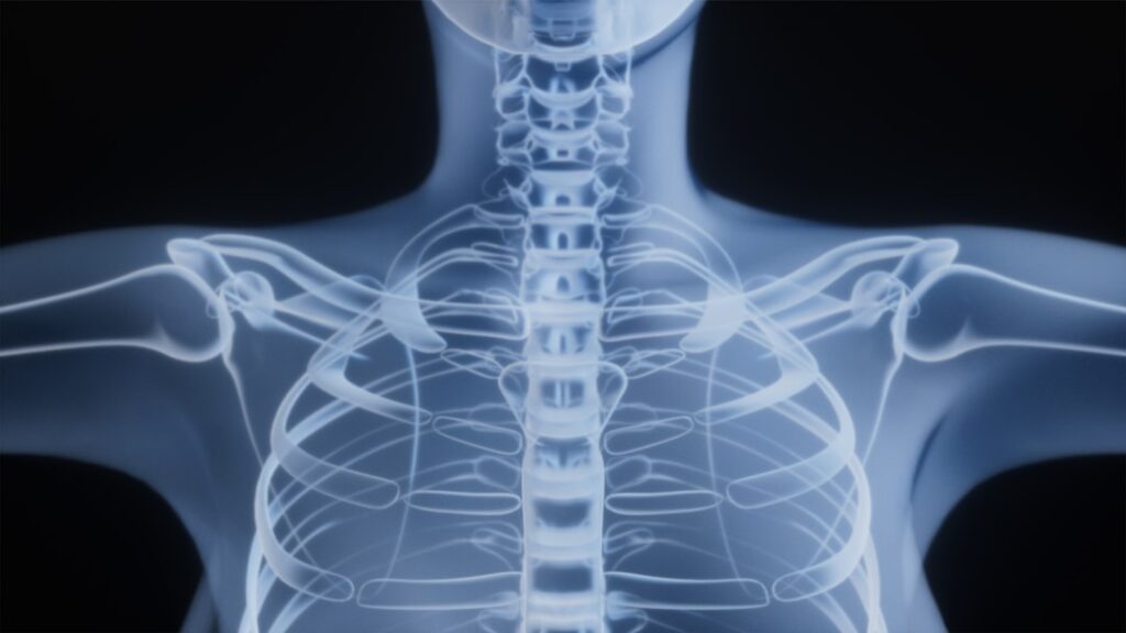 Dexamethasone vs Prednisone: Differences, Uses, and Which Is Better