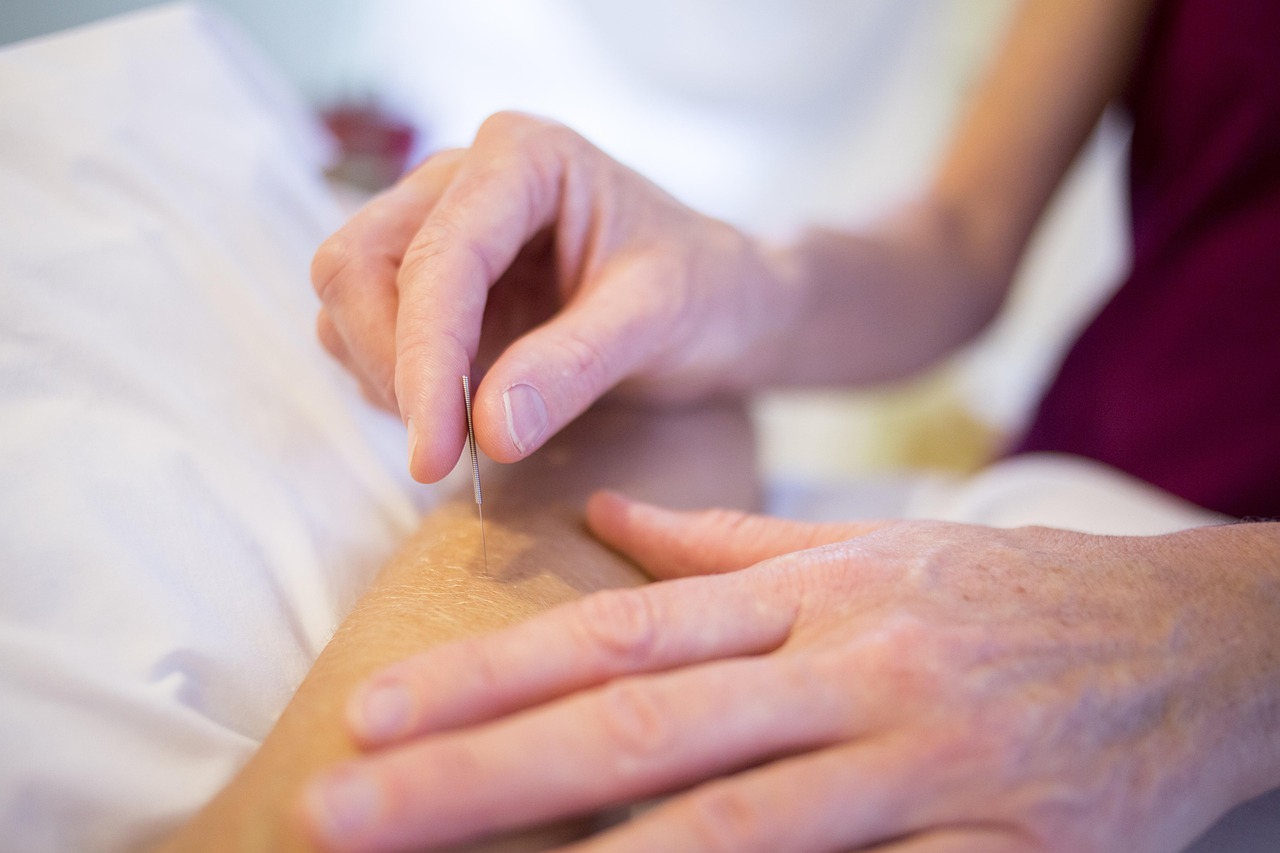 Find a Functional Medicine Doctor Near You: What to Expect 6 acupuncture, holistic healing, holistic, medicine, health, treatment, doctor, acupuncture, acupuncture, acupuncture, acupunct