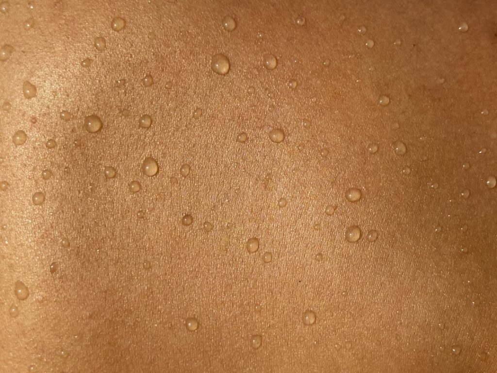 Hidradenitis Suppurativa Medication: Prescription and OTC Options