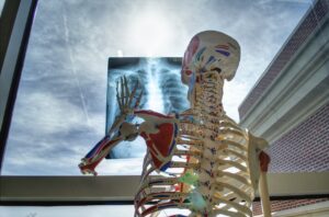 hip replacement guide