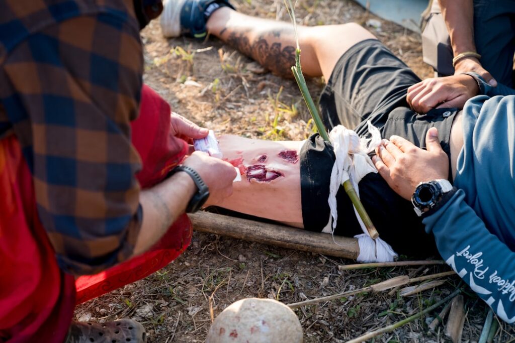 How to Treat a Second Degree Burn: First Aid and Recovery