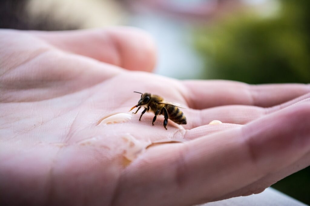 How to Treat a Bee Sting: First Aid Steps and When to Get Help