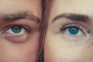 how to treat a stye