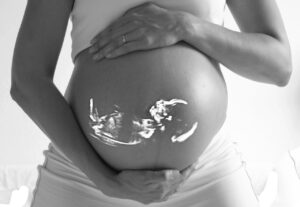 is warfarin safe in pregnancy
