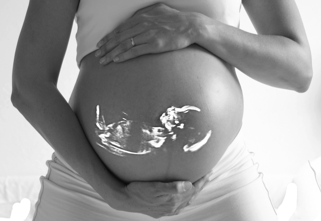 pregnant, baby, echo, ultrasound, pregnancy, belly, family, expecting, mother, woman, fetus, ultrasound, ultrasound, ultrasou