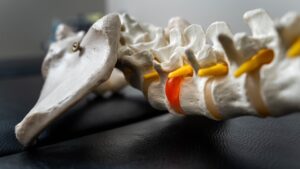 menopause and bone health guide