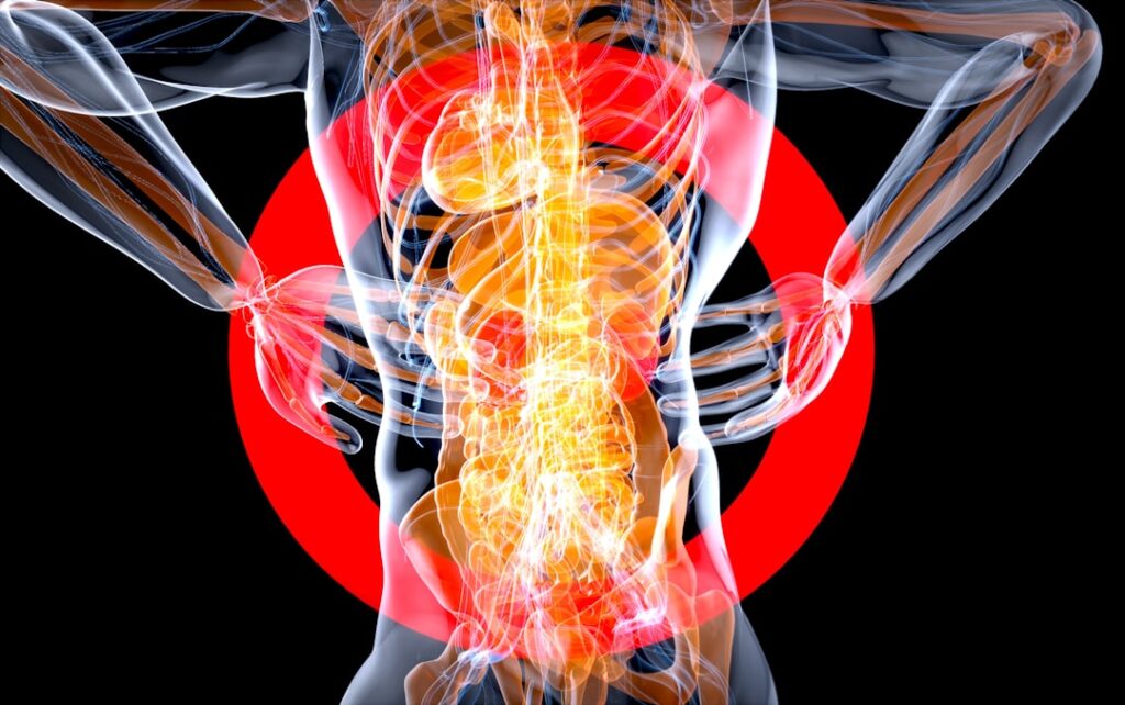 Naproxen vs Ibuprofen for Inflammation: Which Works Better?