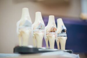 osteoarthritis guide