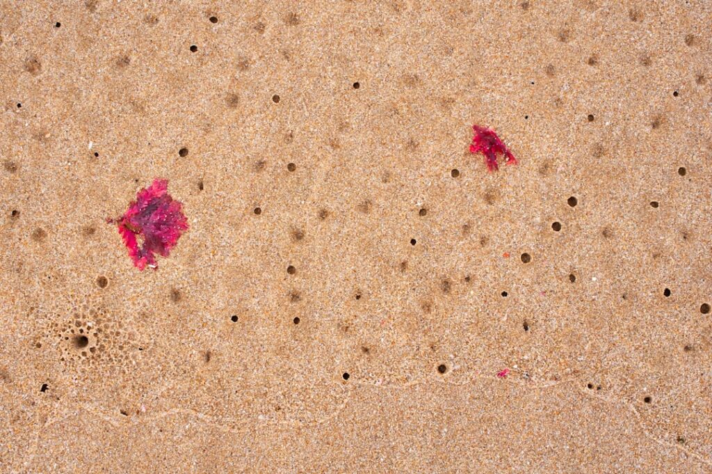 Petechiae: When to Worry About Red Spots Under the Skin
