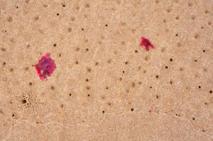 petechiae when to worry