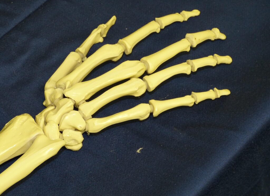 Rheumatoid Factor (RF) Test: What Your Results May Mean