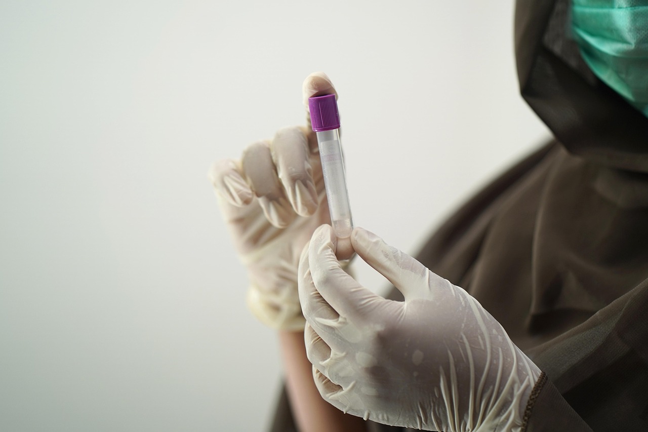 Sample Appeal Letter For Denied Claims: Template and Tips 5 blood test, blood sample, medical technology, medical technologist, surgical gloves, face mask, sample, hospital worker, labo