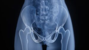 symptoms of bladder cancer
