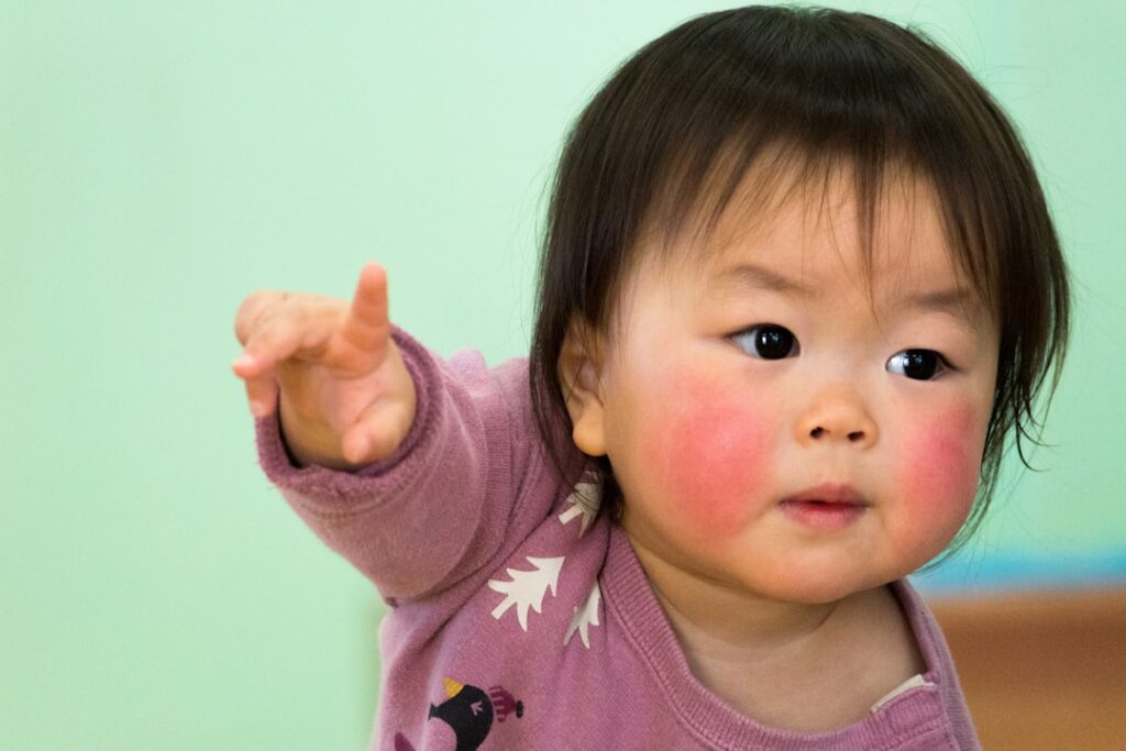 Symptoms of Hand, Foot, and Mouth Disease in Adults