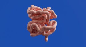 symptoms of rectal cancer
