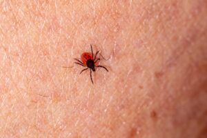 symptoms of tick head left in skin