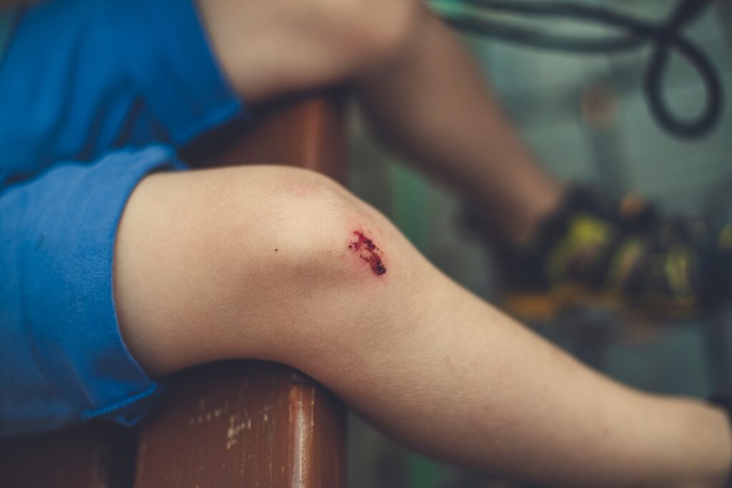 Symptoms of a Torn Meniscus: Is Your Knee Injury Serious?