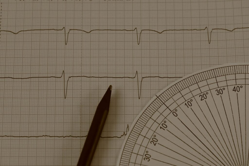 Treatment for AFib: Medications, Procedures, and Lifestyle Changes