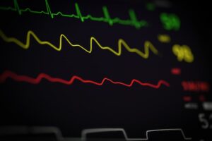 treatment for pots syndrome