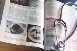 varicocele guide