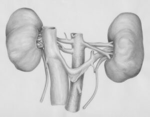 what does a kidney stone feel like