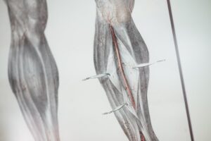 when to worry about calf pain