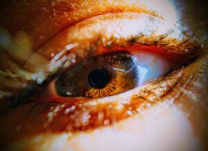 when to worry about eye floaters