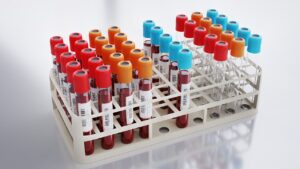 blood test cost