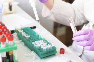 clinical trials for migraine