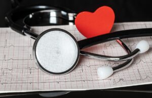 ekg cost without insurance