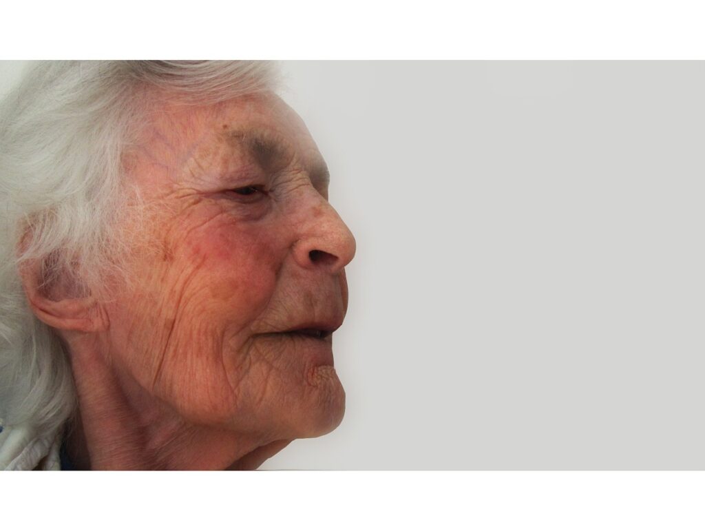 How Long Will Medicare Pay for Home Health Care? Eligibility and Limits