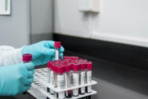 iron tibc test