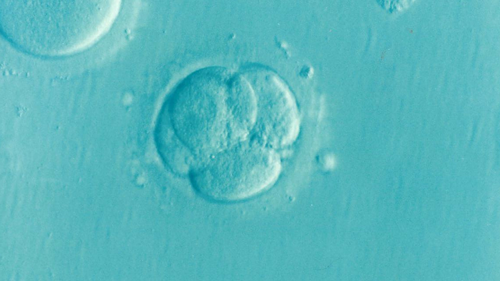 How Much Does IVF Cost? A Complete 2026 Breakdown