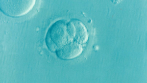 ivf cost
