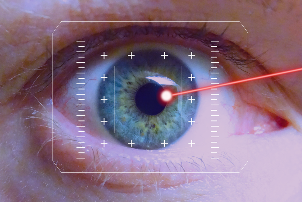 How Much Does LASIK Cost? (2026 Guide)