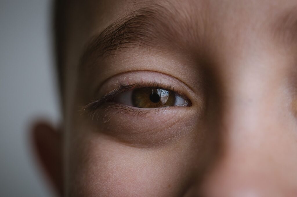 Pink Eye (Conjunctivitis) in Children: Causes and Treatment